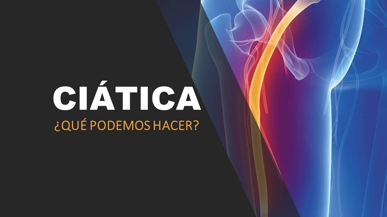 La ciática: ¿Qué puedo hacer?