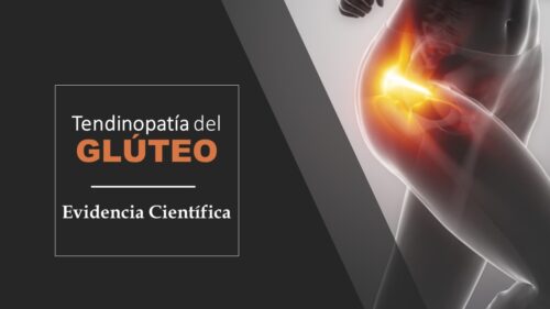 biomecánica tendinitis gluteo