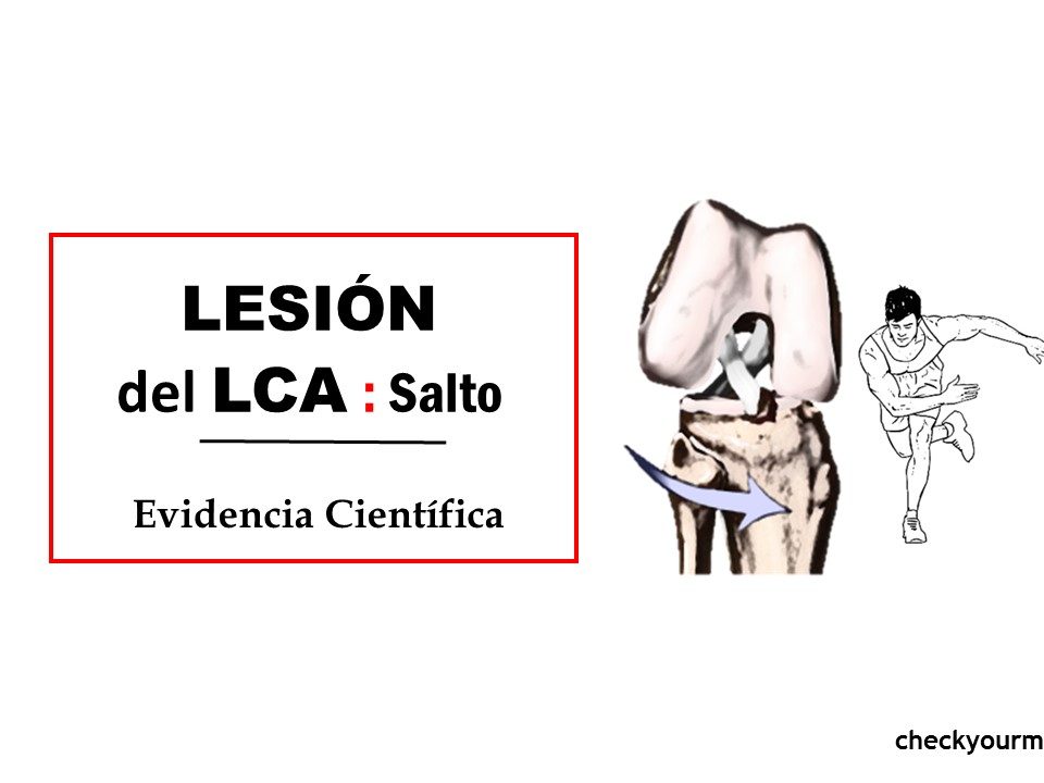 Lesión del ligamento cruzado anterior (LCA) saltos