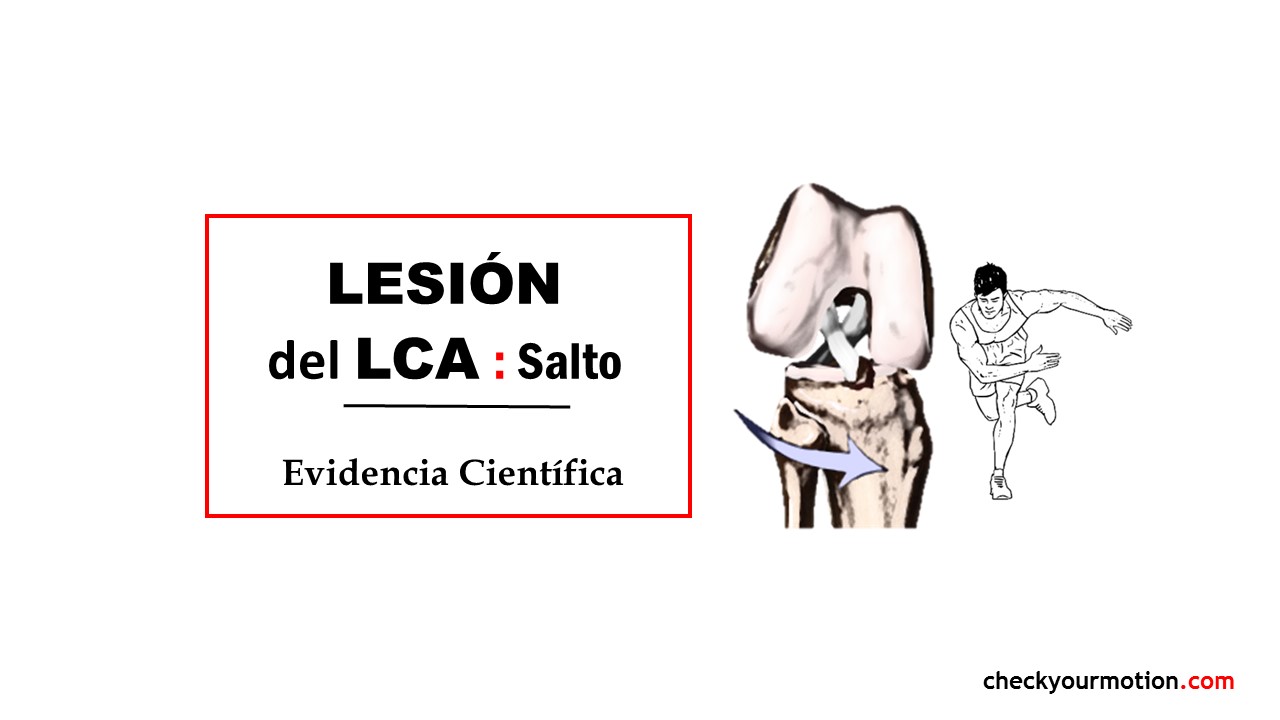 Lesión del ligamento cruzado anterior (LCA)