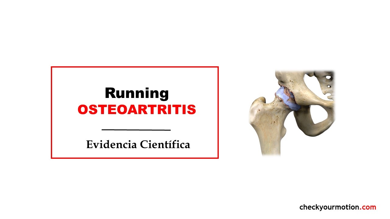 Running y artrosis (osteoartritis)