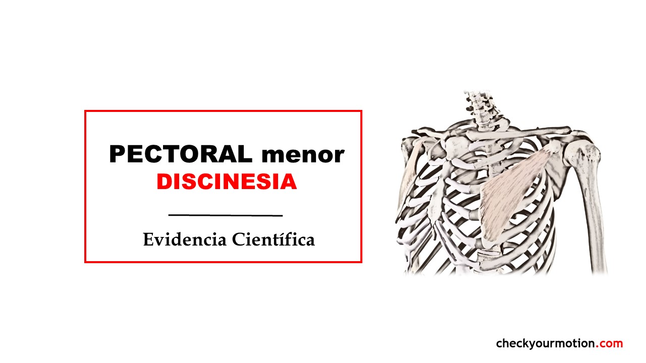 Discinesia: el pectoral menor