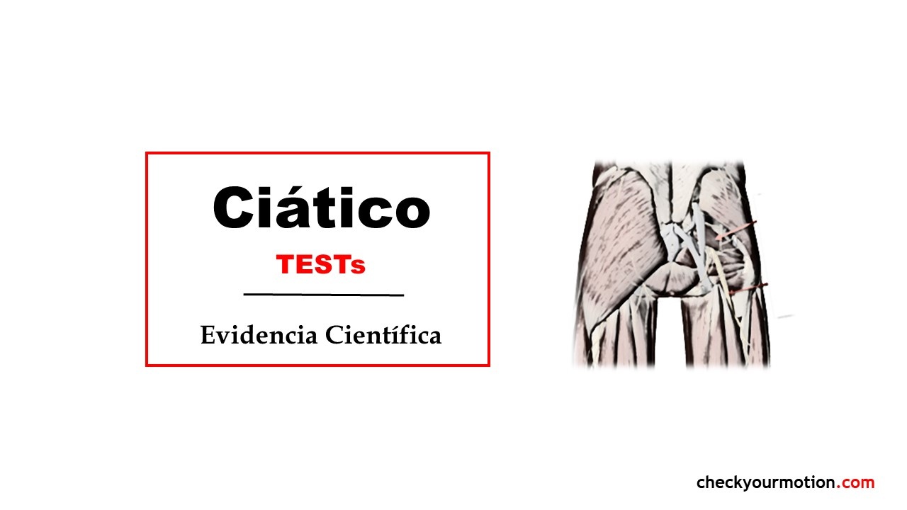 Dolor nervio ciático: tests