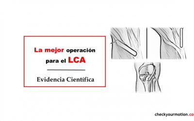 La mejor operación para el ligamento cruzado anterior LCA