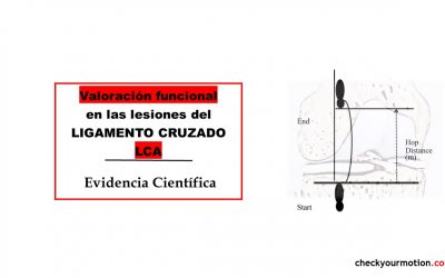 Valoración funcional en las lesiones del ligamento cruzado LCA