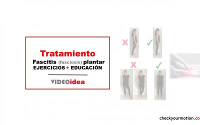 Tratamiento fascitis plantar ejercicios y educación