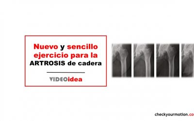Ejercicio terapéutico para artrosis de cadera