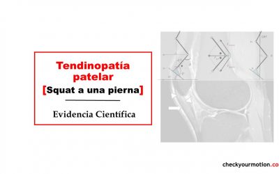 🦵Squat a una pierna como test para la tendinopatía patelar