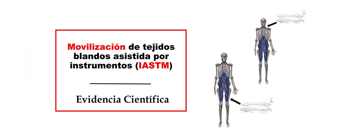 Movilización de tejidos blandos asistida por instrumentos (IASTM) cadenas miofasciales